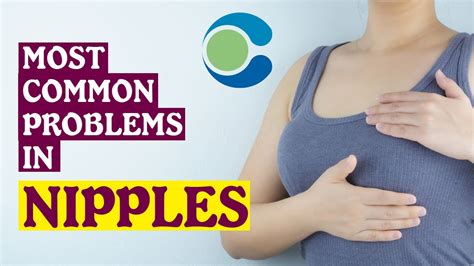 slit in nipple|Nipple Problems and Discharge .